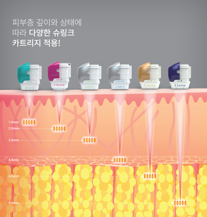 슈링크3-피부층깊이에따라