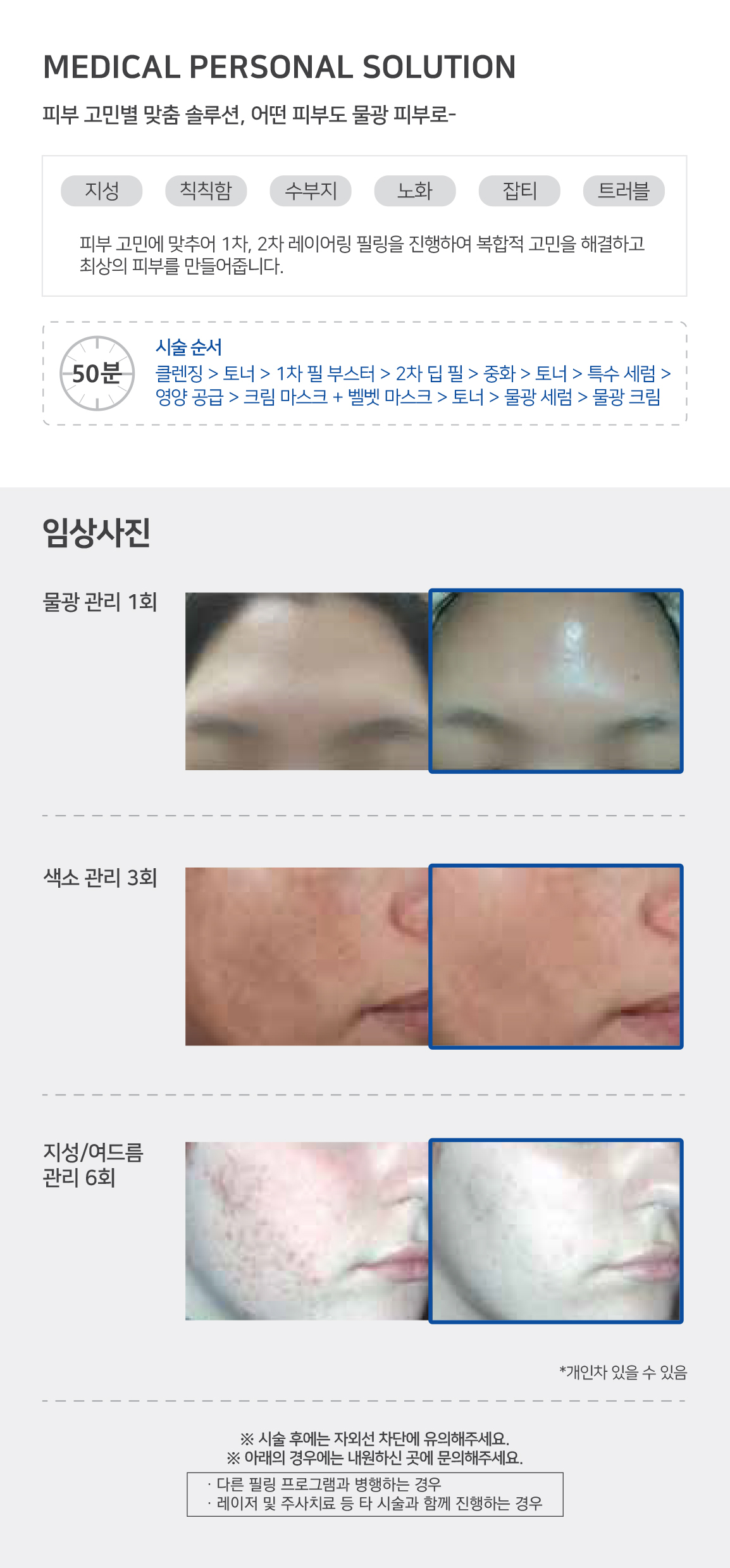 물톡스3.jpg