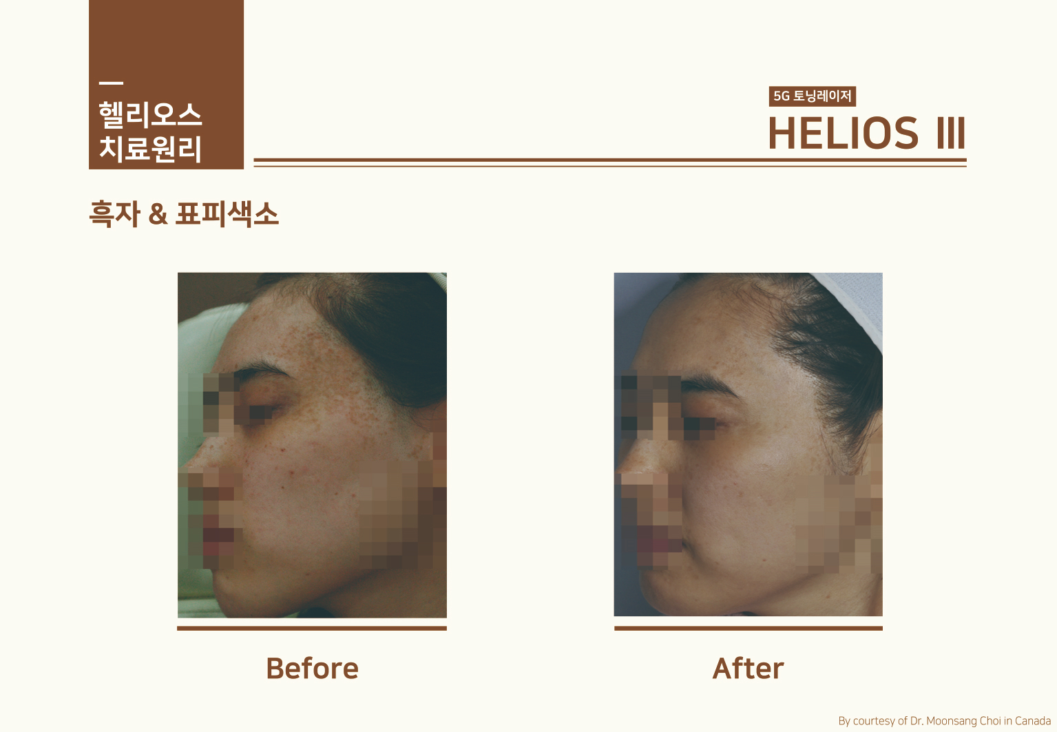 헬리오스_14.jpg