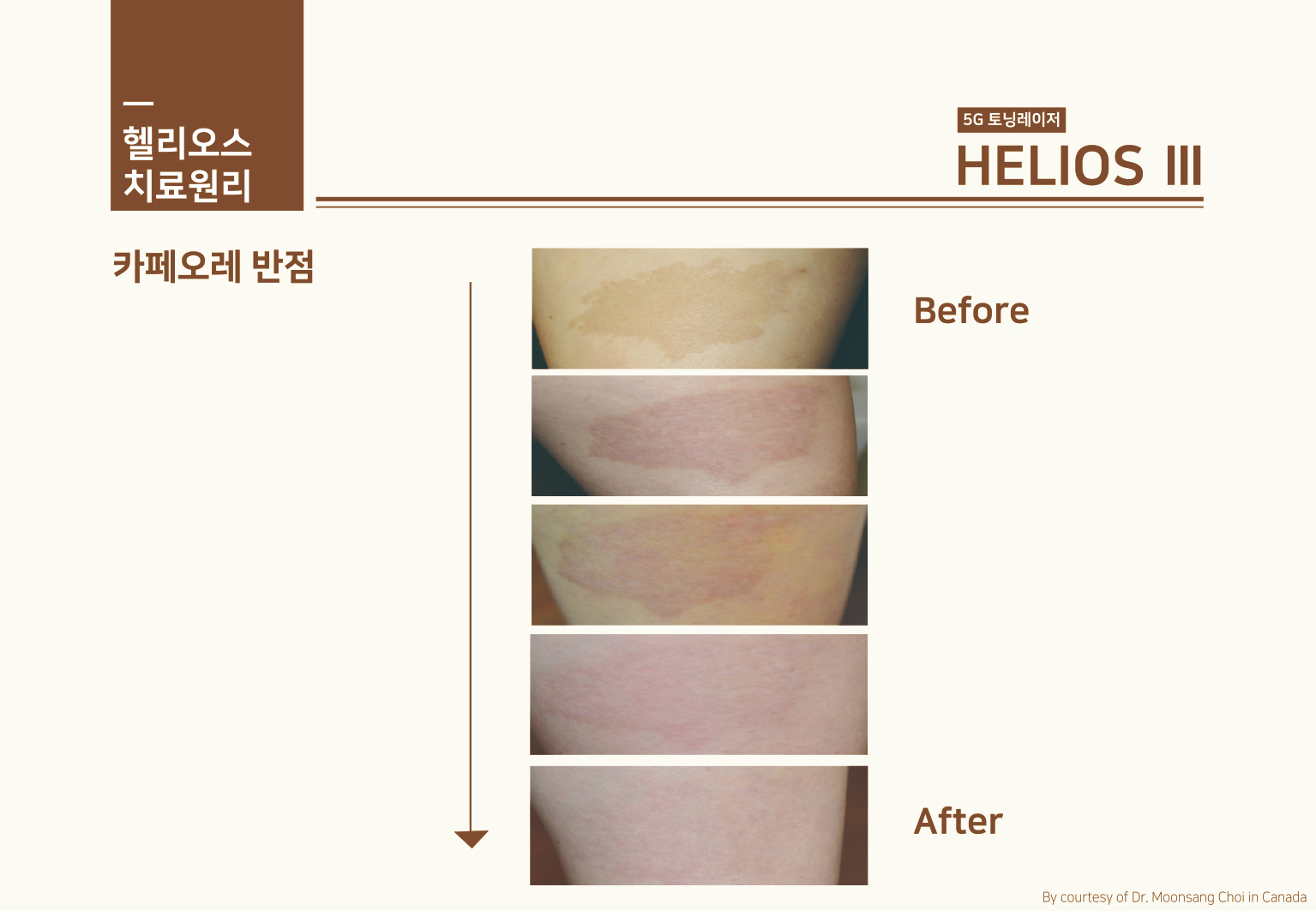 헬리오스_15.jpg
